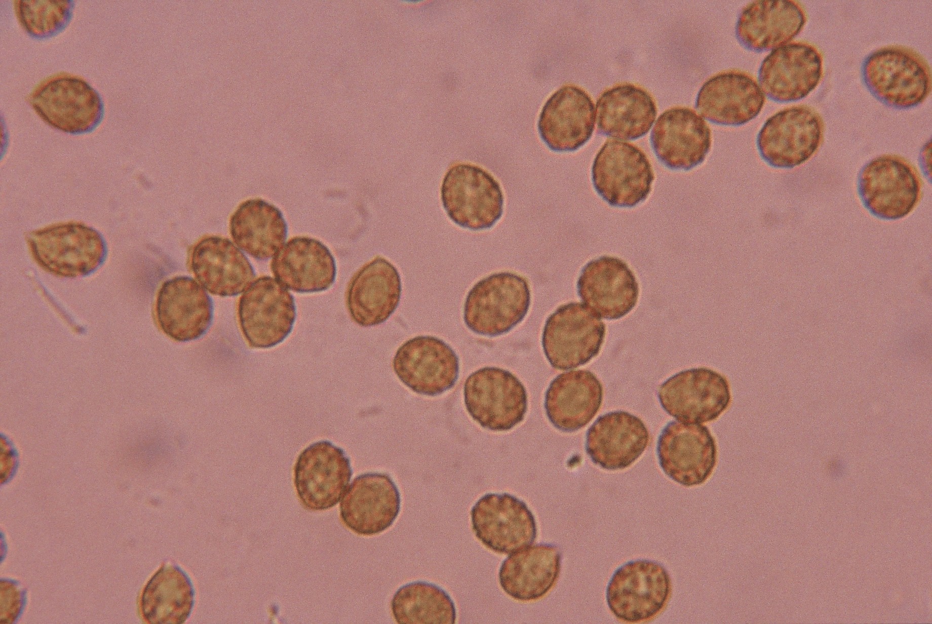 cortinarius cotoneus microscopia