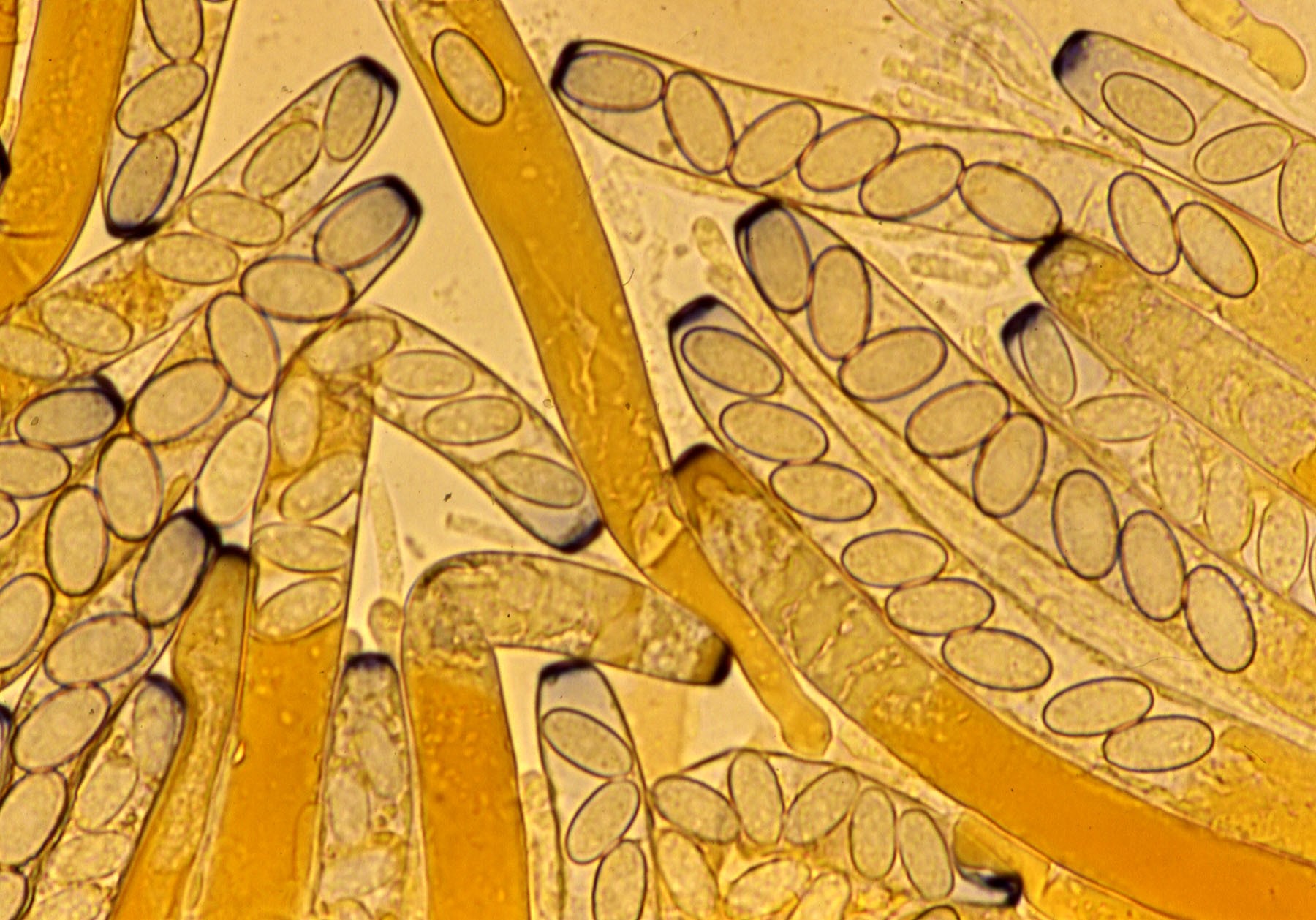 microscopia aschi peziza fimeti