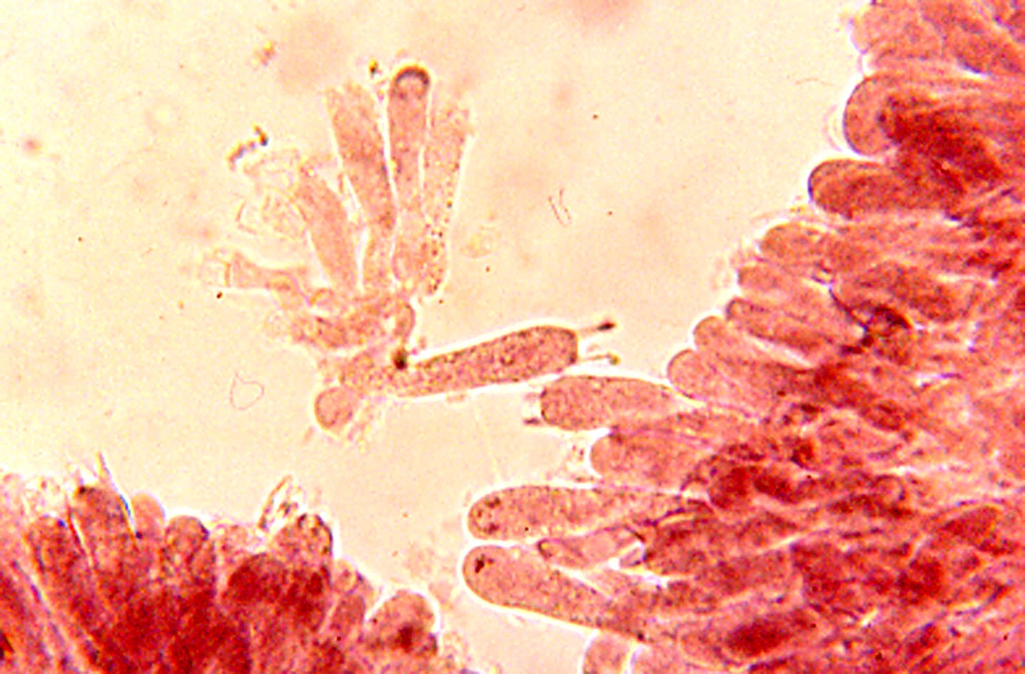 microscopia basidi rugosomyces obscurissimus