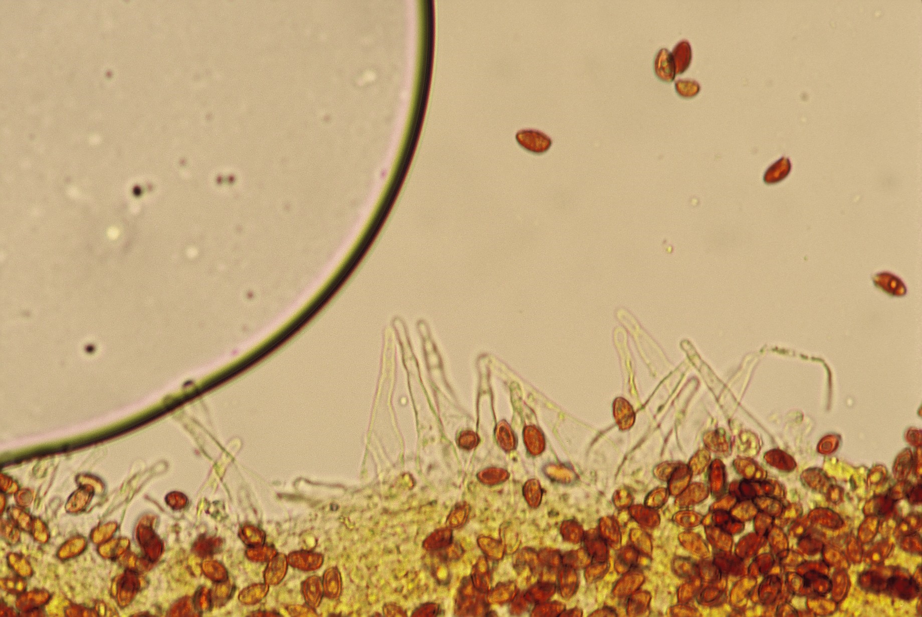 microscopia cheilocistidi galerina unicolor