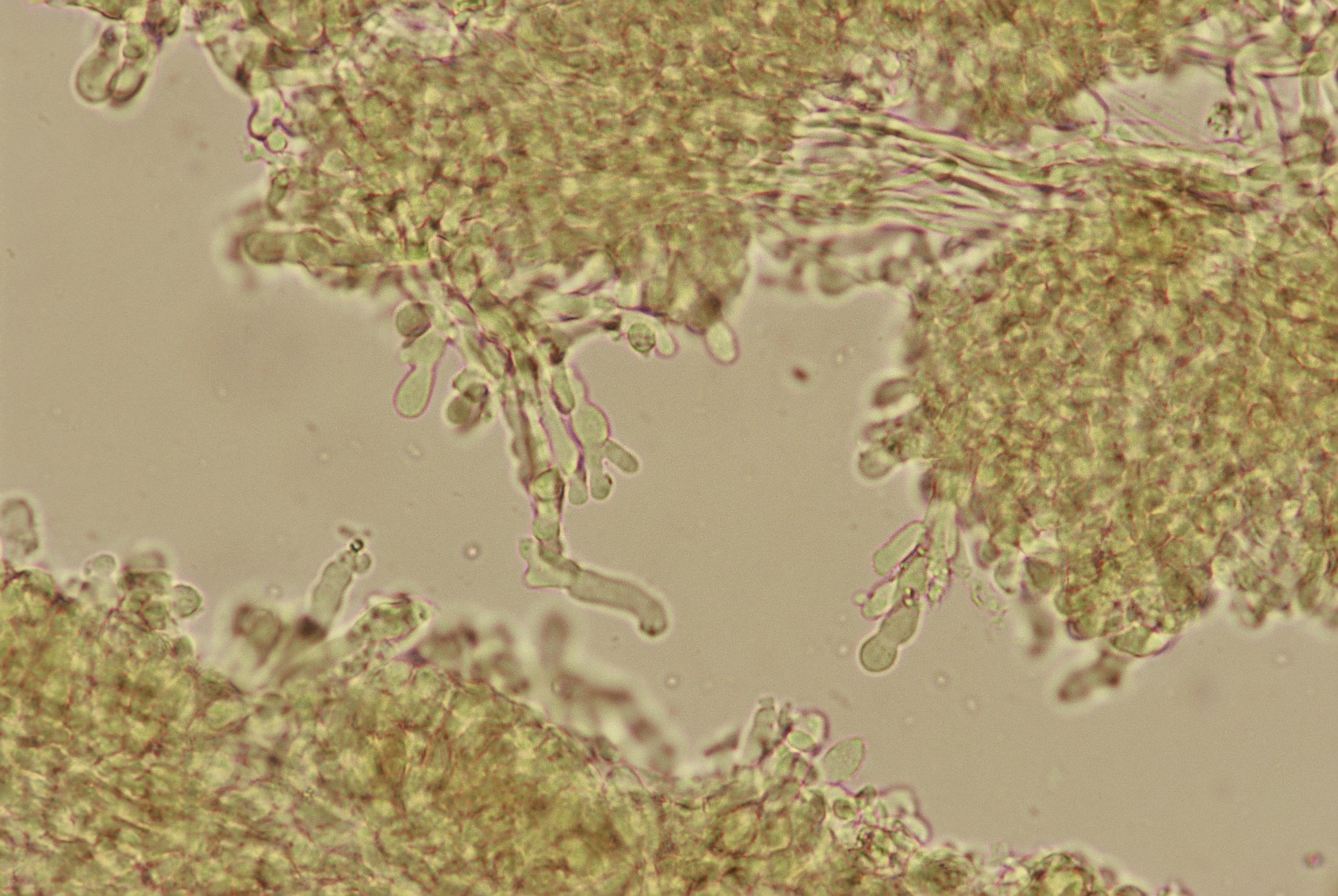 microscopia cheilocistidi gymnopus confluens