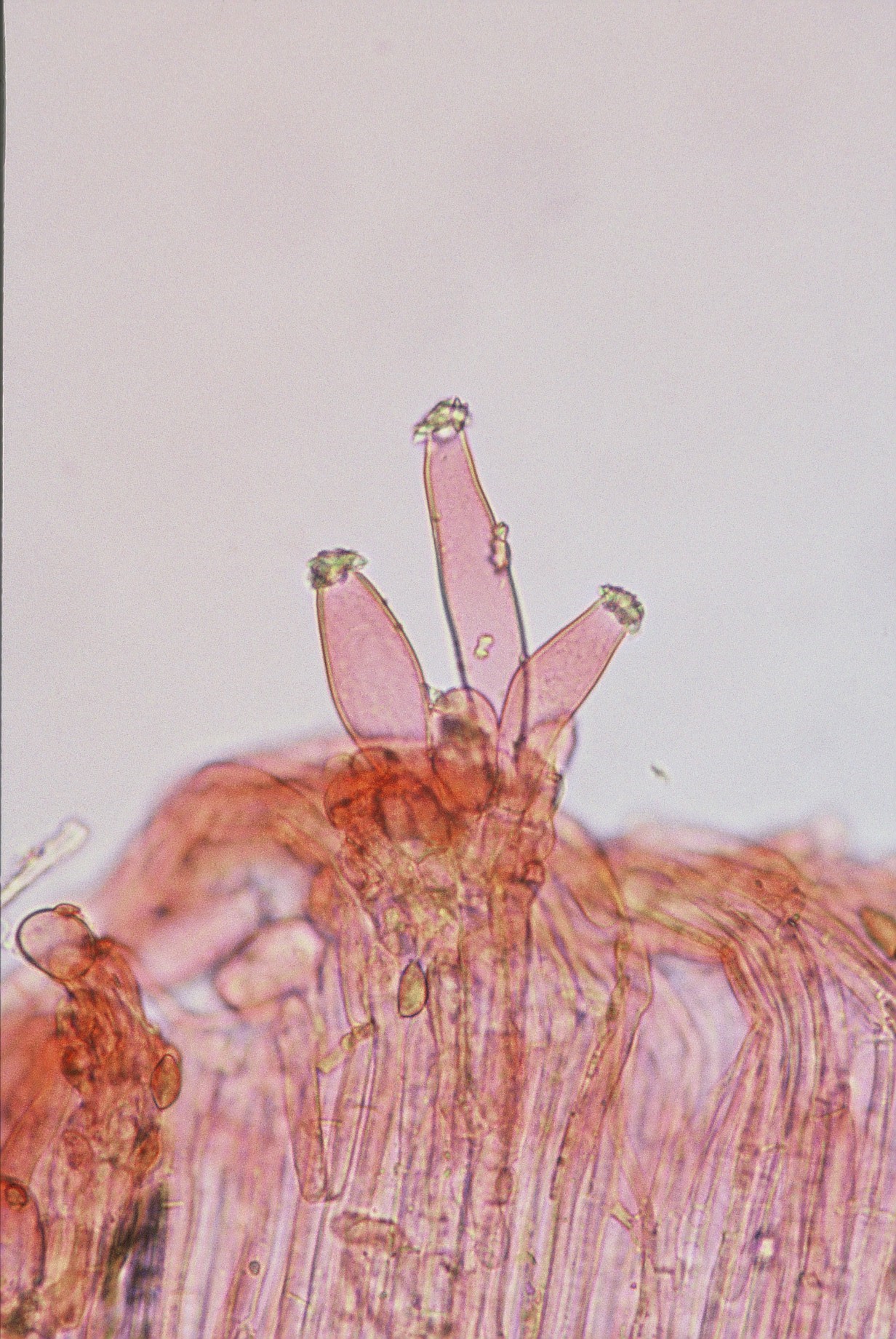 microscopia cistidi inocybe godeyi
