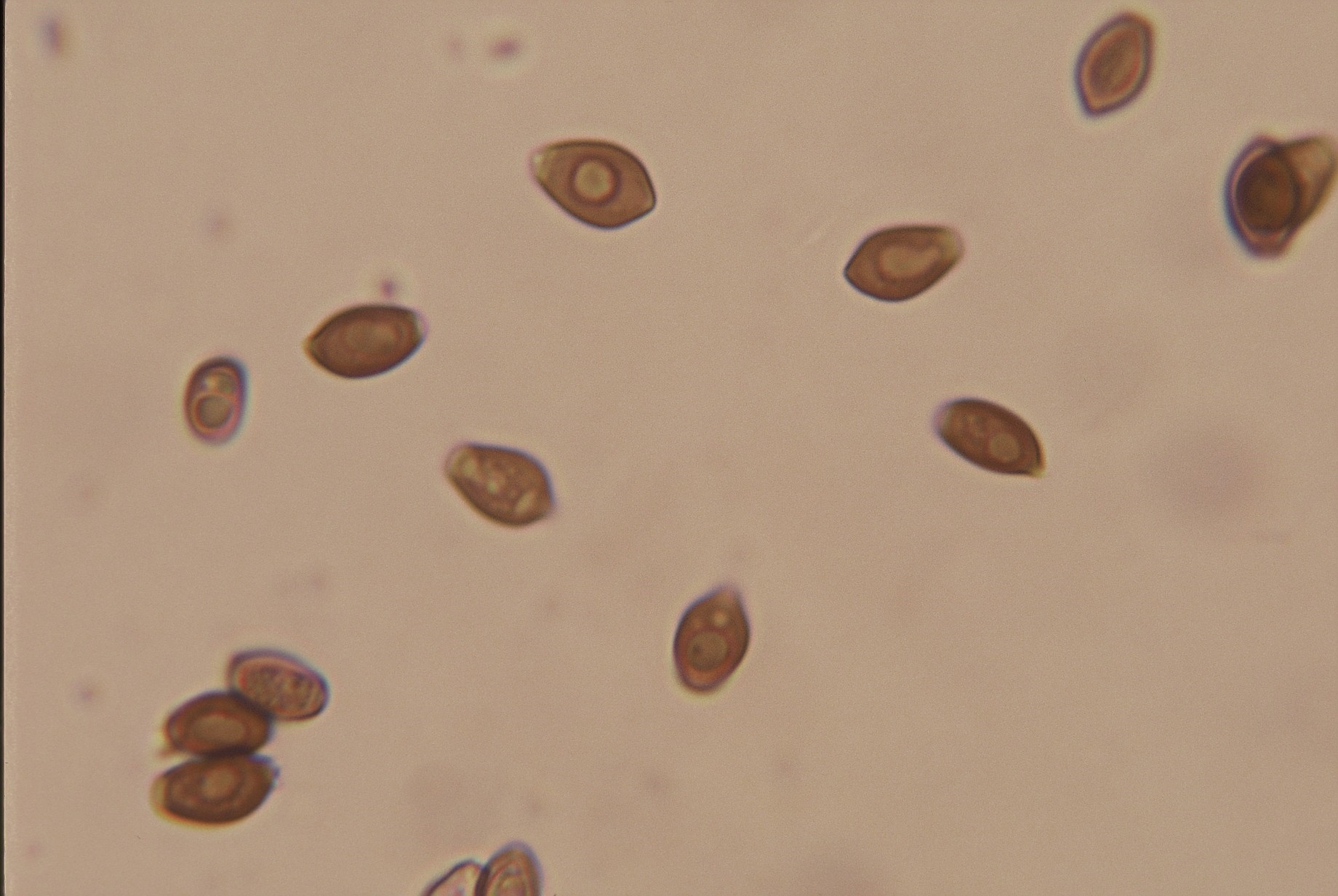 microscopia coprinus micaceus