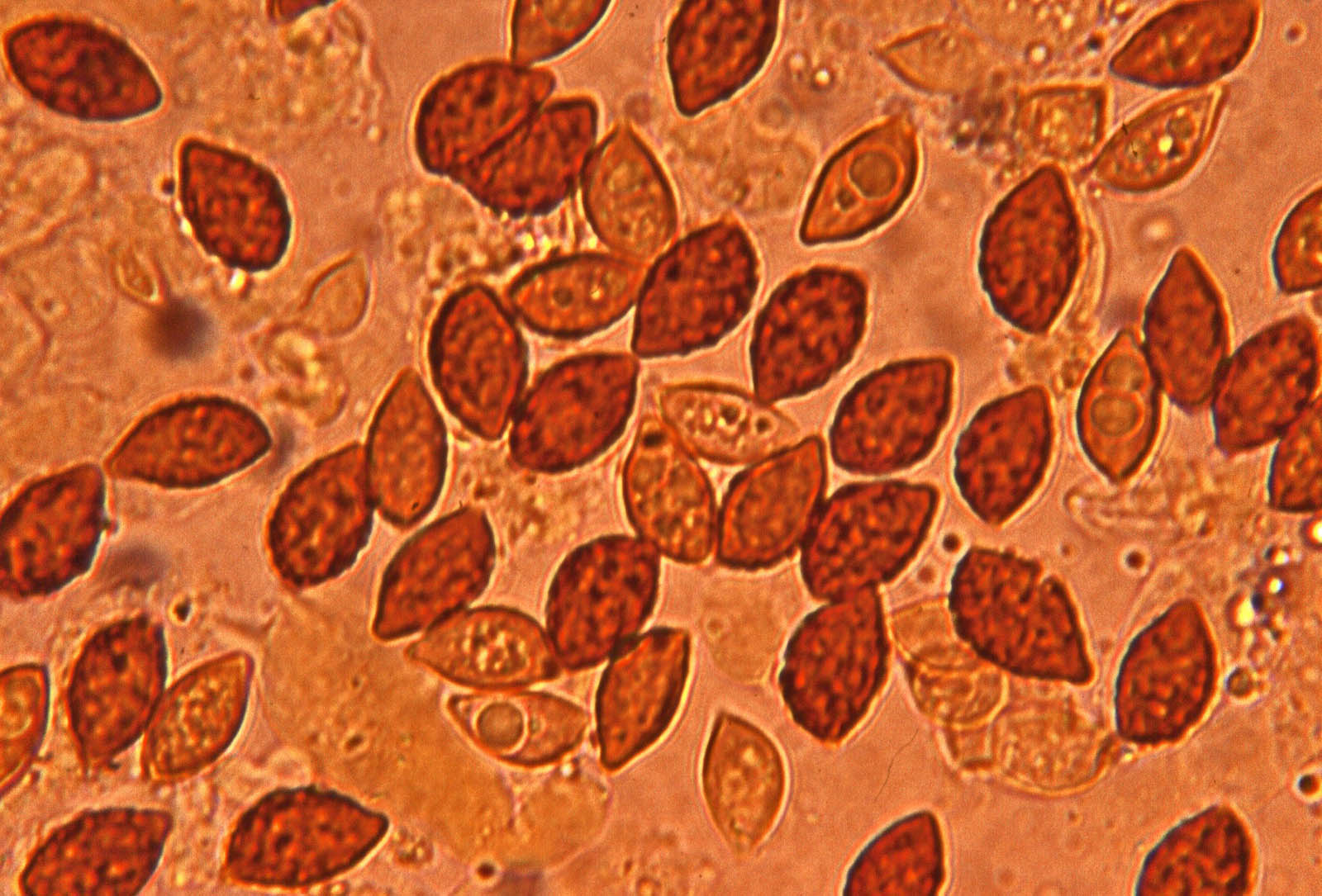 microscopia cortinarius meinhardii