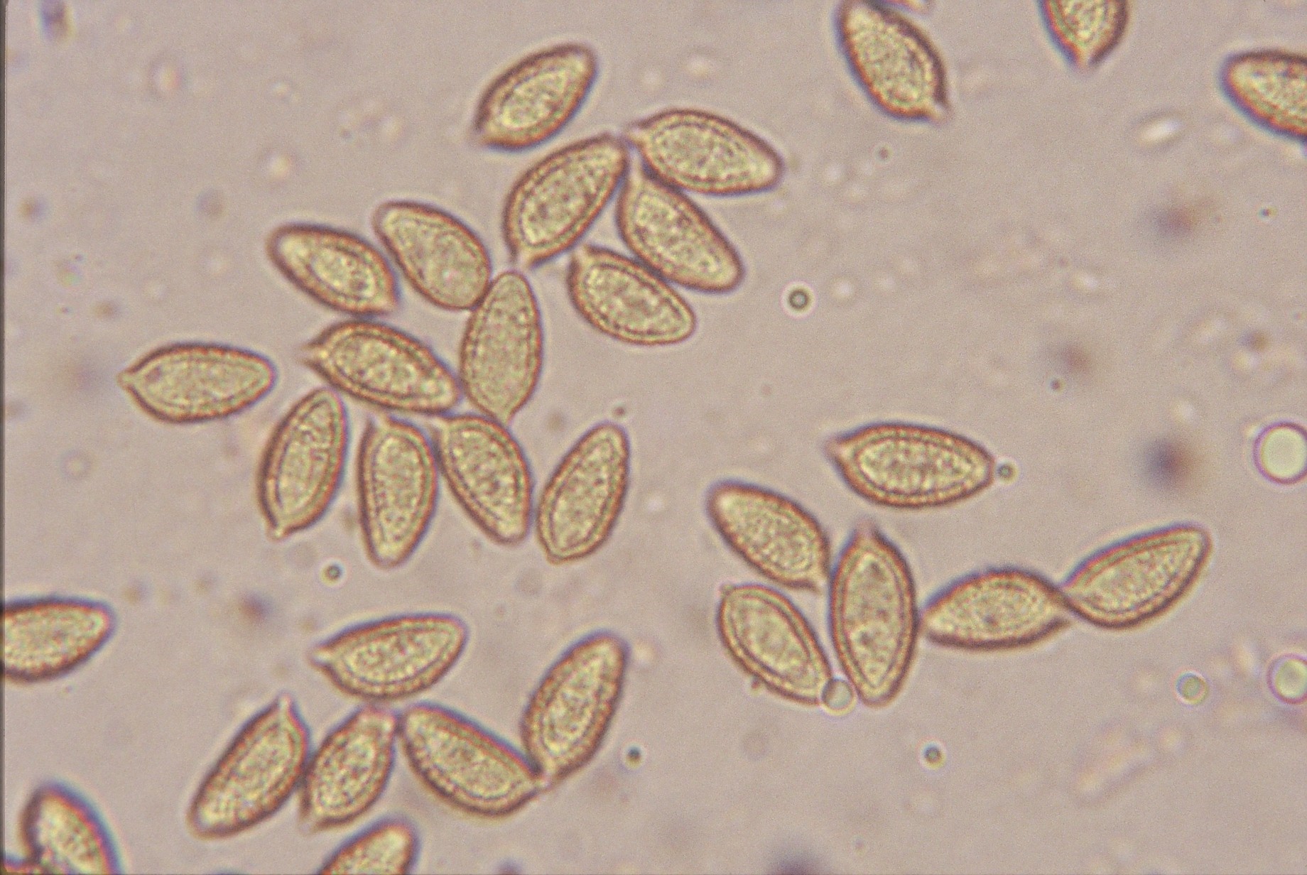 microscopia hebeloma edurum