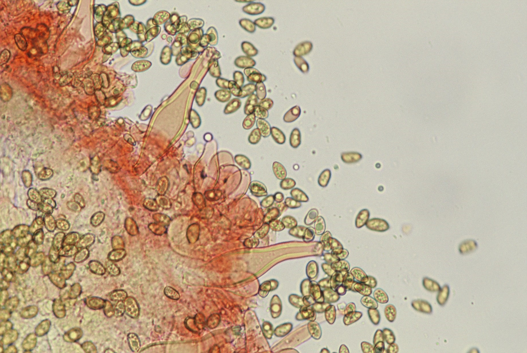 microscopia inocybe fascidula