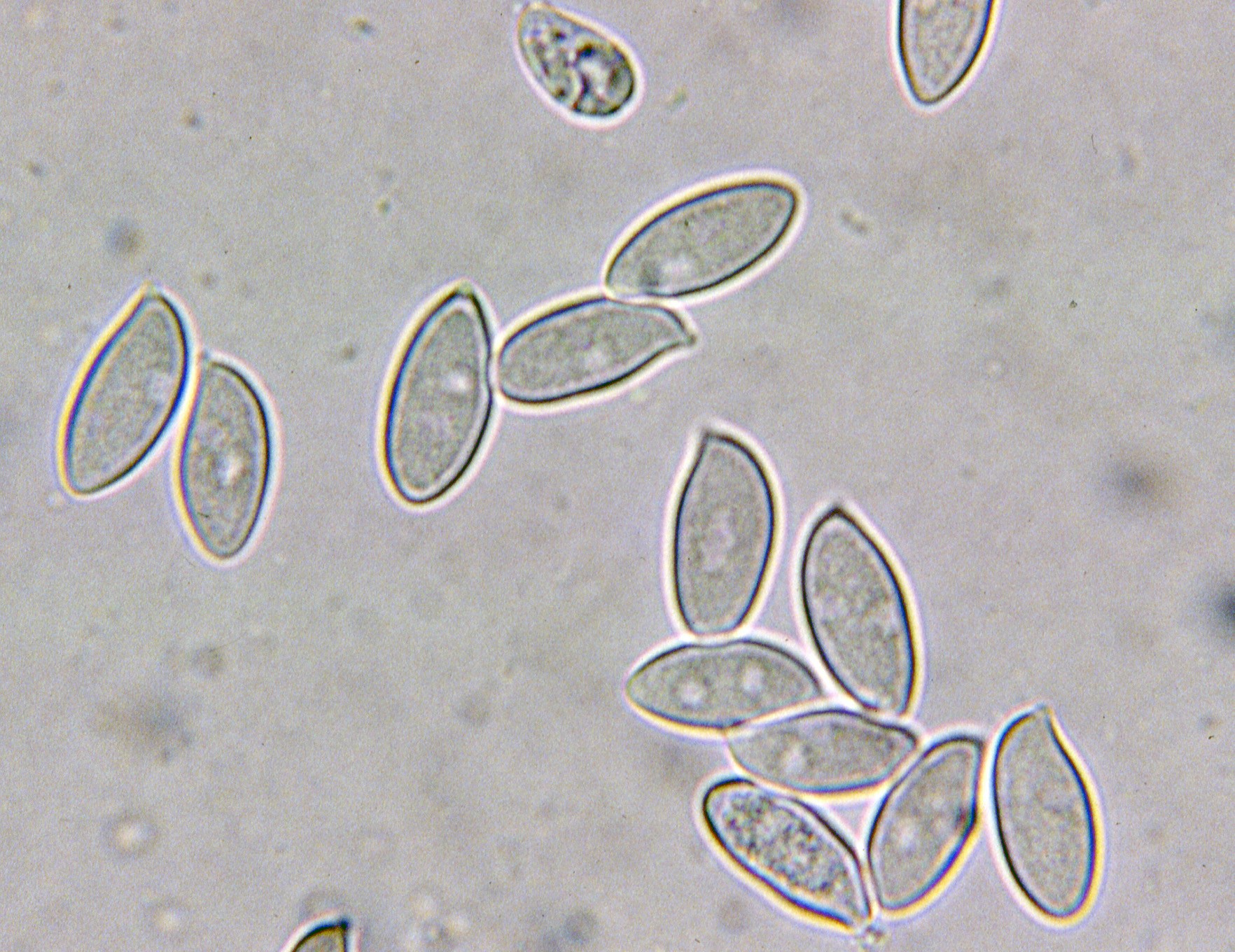 microscopia lepiota oreadiformis
