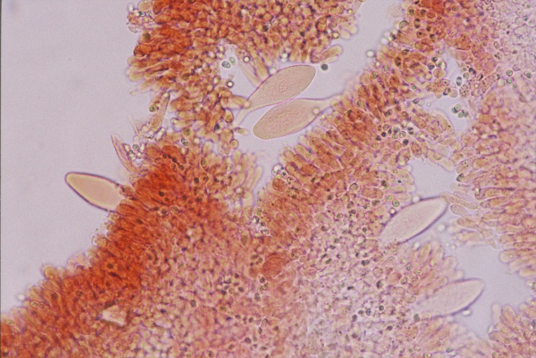 microscopia sez. lamella x 400 chamaemyces fracidus