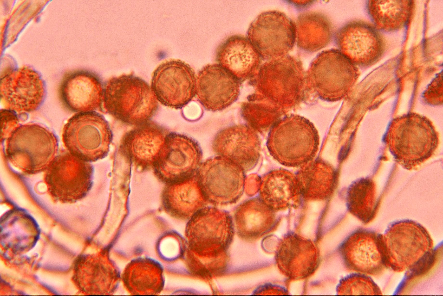 microscopia spore astraeus hygrometricus