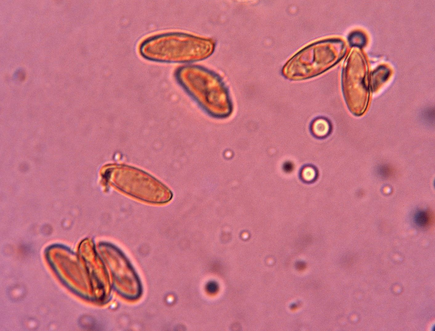 microscopia spore boletus fragrans