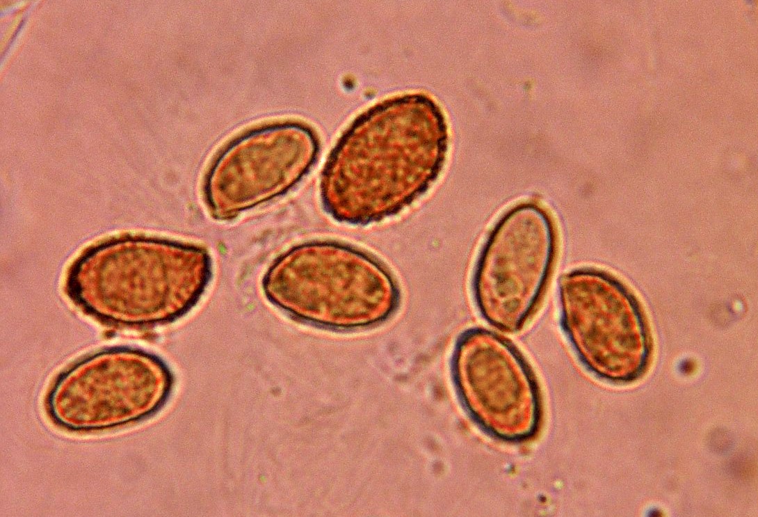 microscopia spore cortinarius  mairei var. juranus