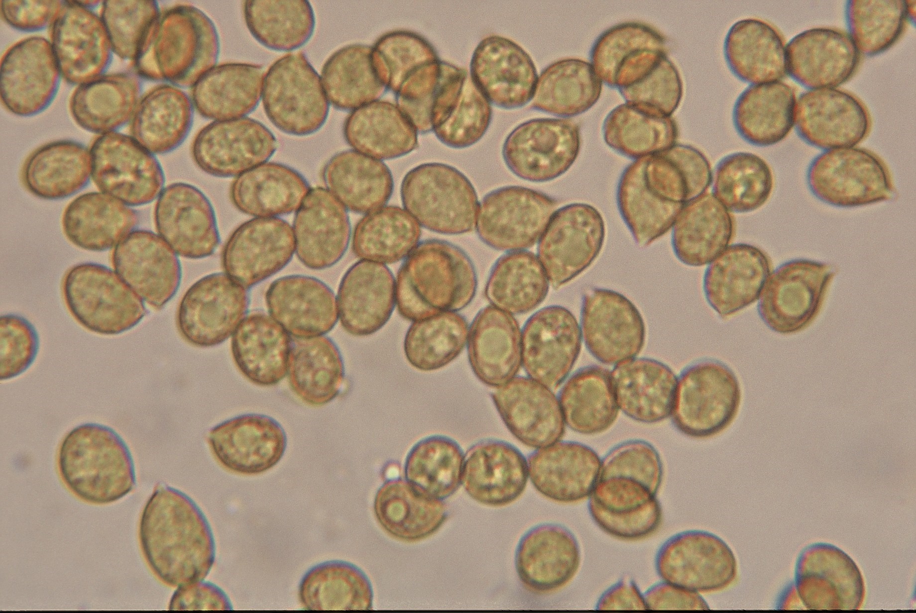 microscopia spore cortinarius anomalus