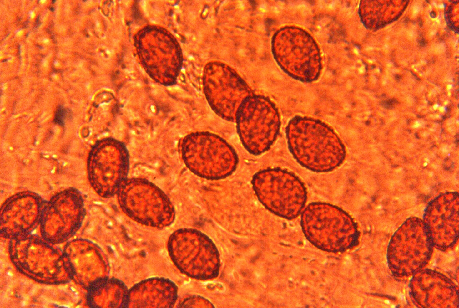 microscopia spore cortinarius hercynicus