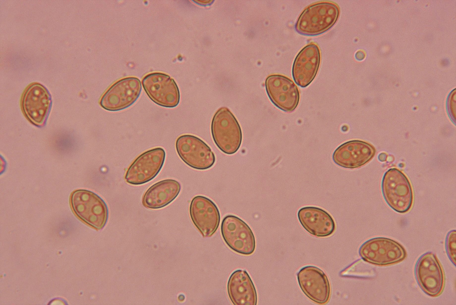 microscopia spore inocybe geophylla