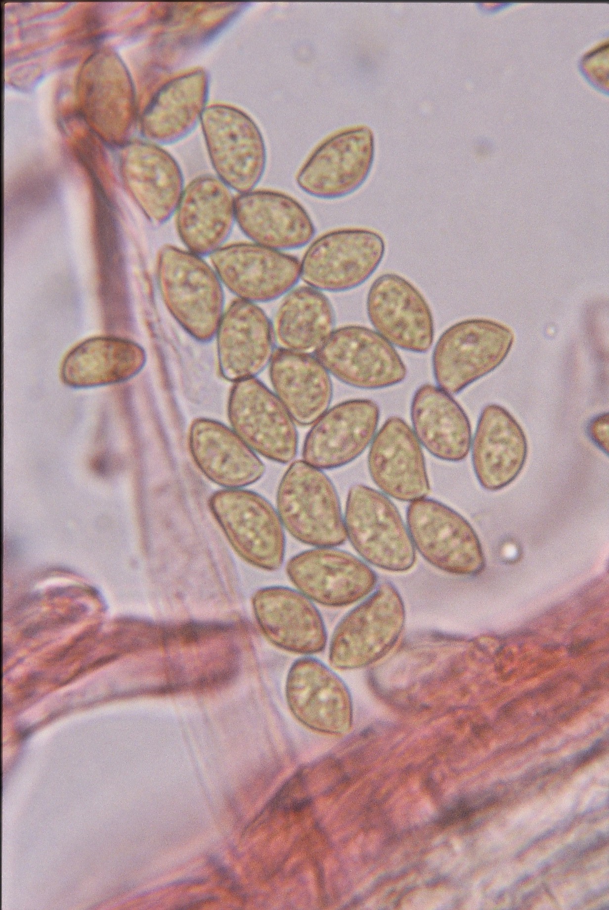 microscopia spore inocybe godeyi