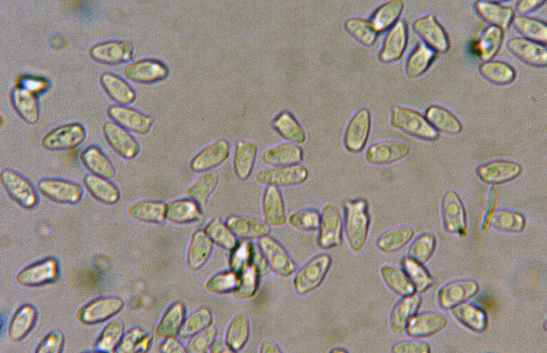 microscopia spore lepiota cristata
