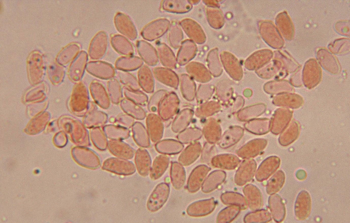 microscopia spore rugosomyces obscurissimus