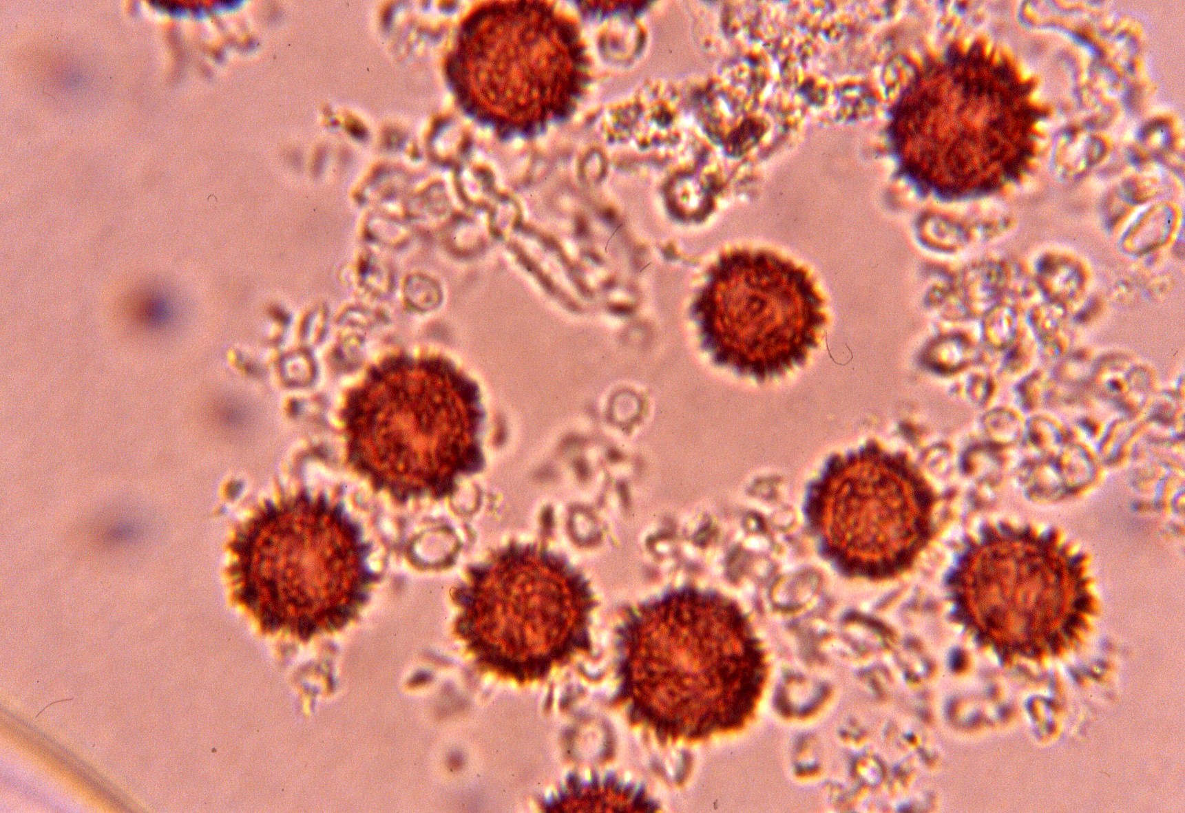 microscopia spore scleroderma areolatum