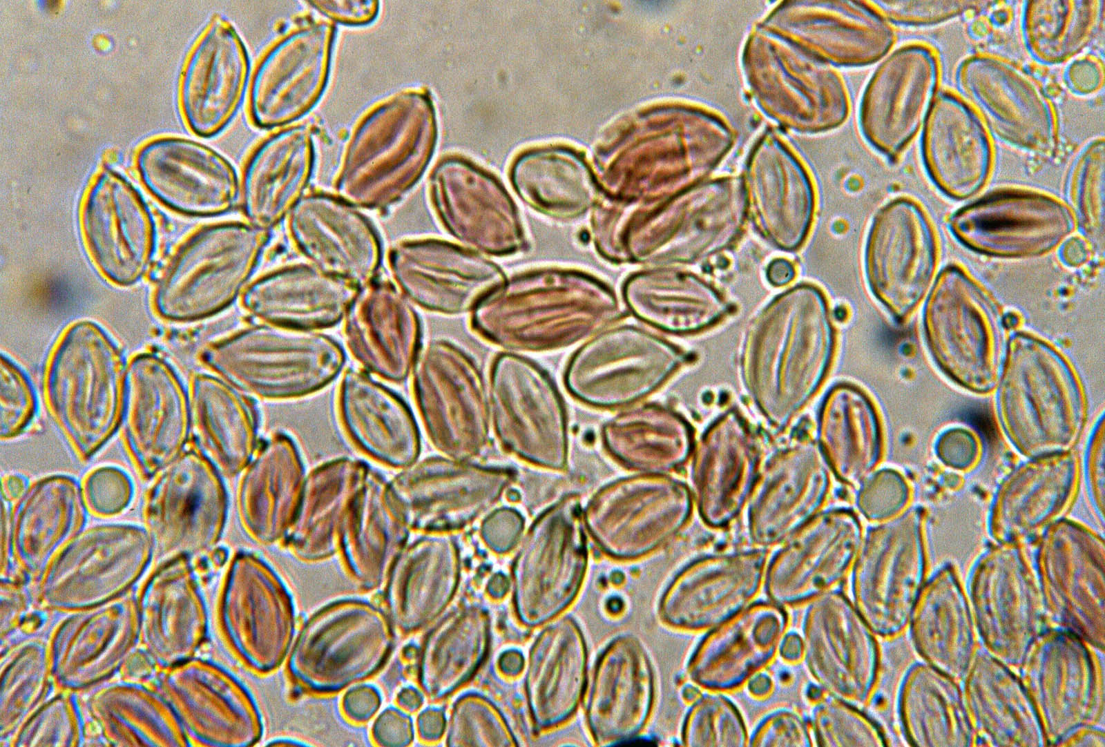 spore di clitopilus punulus al microscopio