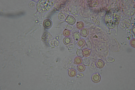 spore100x